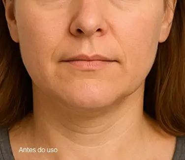 antes-legenda.webp