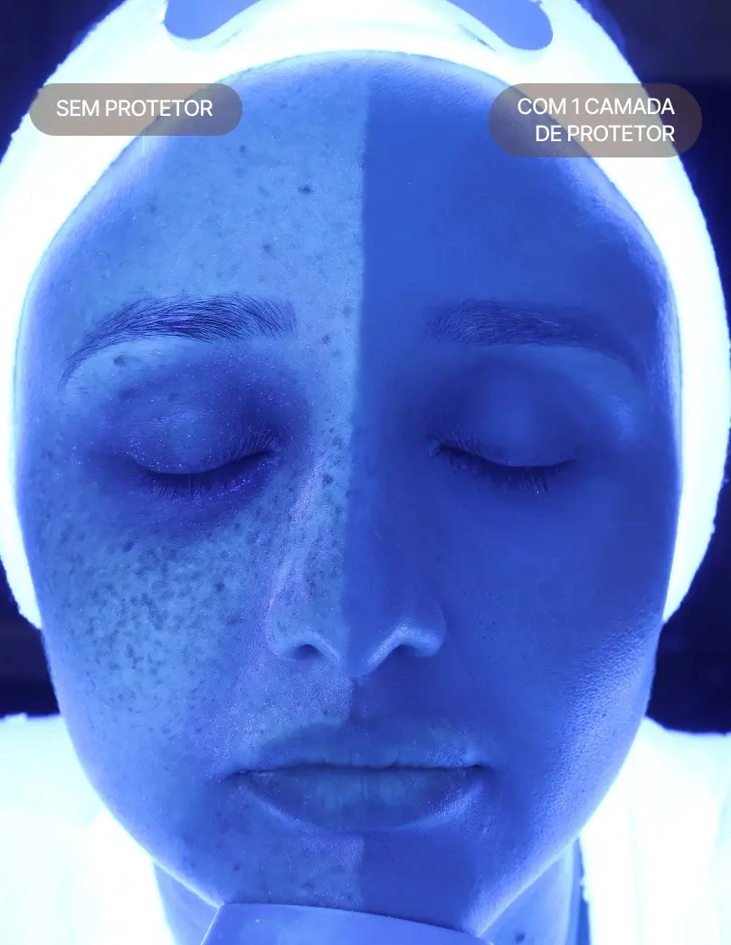 luz-uv.webp