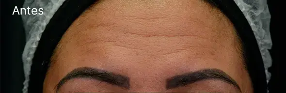 Antes.webp