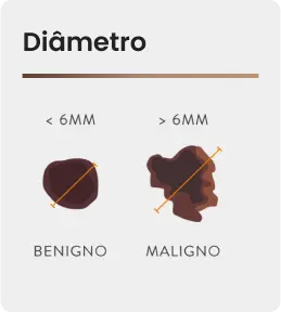 Diâmetro.png