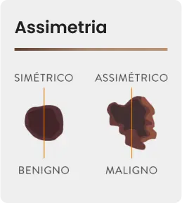 Assimetria.png