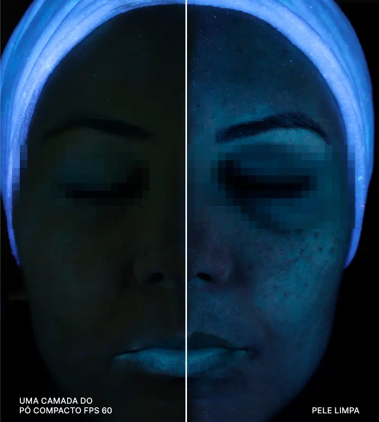 antes-depois-uv.webp